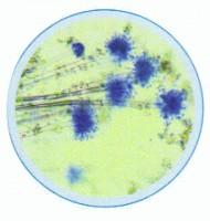 Set lame bacterii, fungi , licheni, sporulate - 15 lame