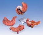 Mulaj stomac-duoden-pancreas