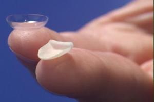 Estetica dentara implantologie