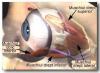 Ochelari stenopici - pinhole. vindeca