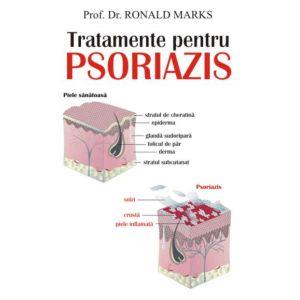 Psoriazis tratamente