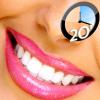 Tratamente de albire dentara smile flash