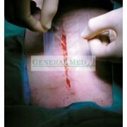 Sistem de inchidere chirurgicala adeziva Steri-Strip